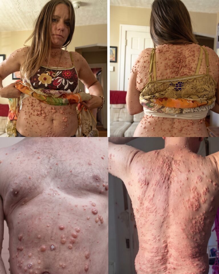 Sleeping Conditions That Can Quietly Destroy Your Skin