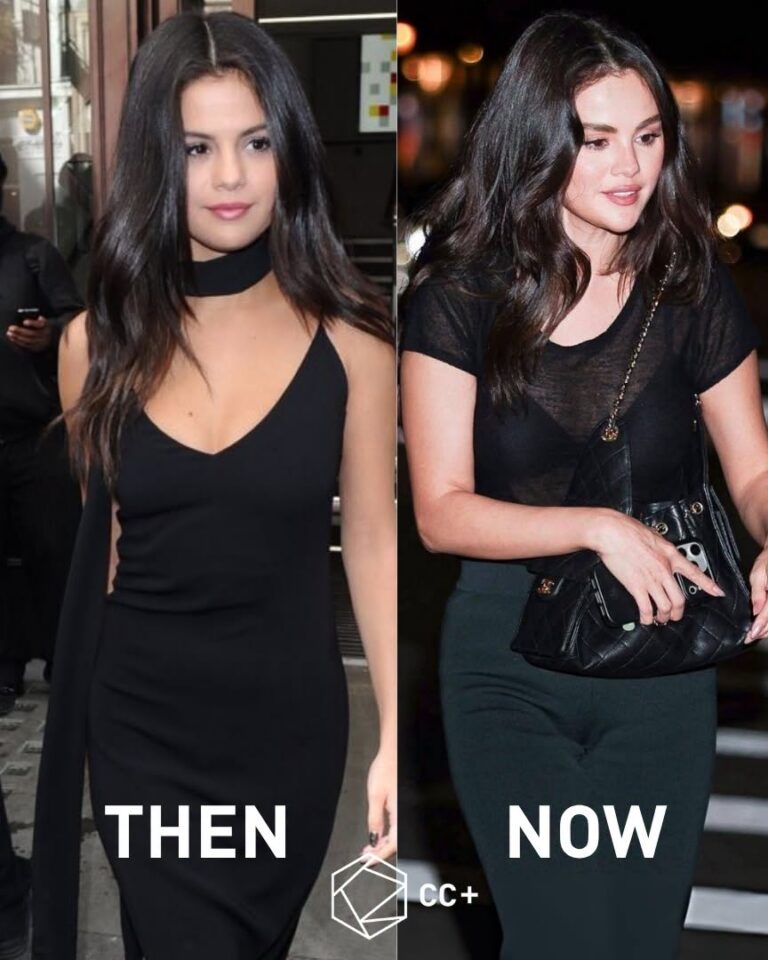 Selena Gomez Looks Like Her Younger Self Again — And Fans Are Noticing 😍✨