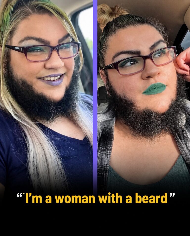 After 16 Years of Hiding, Coral Renaie Decided to Stop Shaving