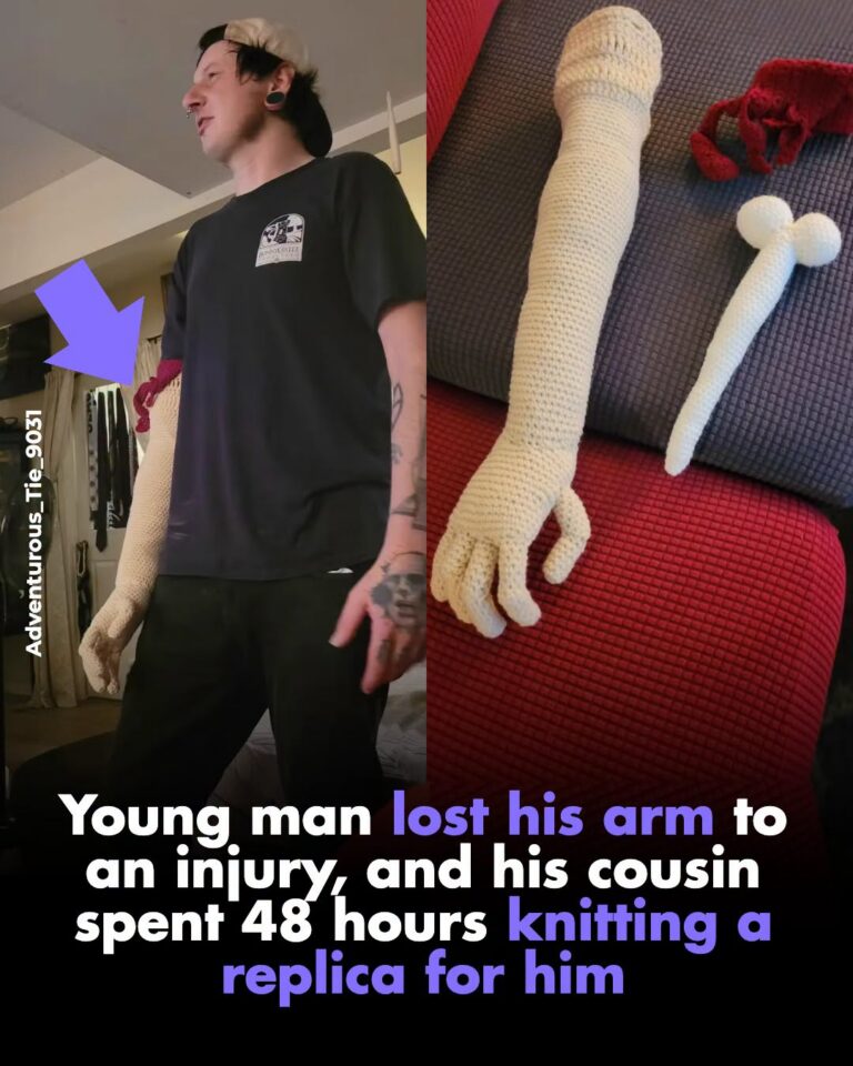 Young man lost his arm to an injury, and his cousin spent 48 hours crocheting a replica for him