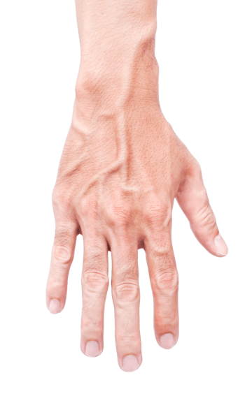 If You Can See Veins in Your Hands, Here’s What It Really Means for Your Body