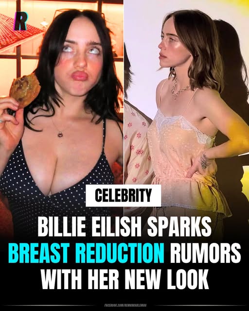 Billie Eilish is at the centre of plastic surgery rumours after